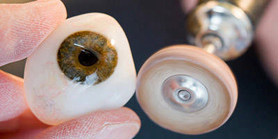 Protesis_oculares-ocular_ocularista